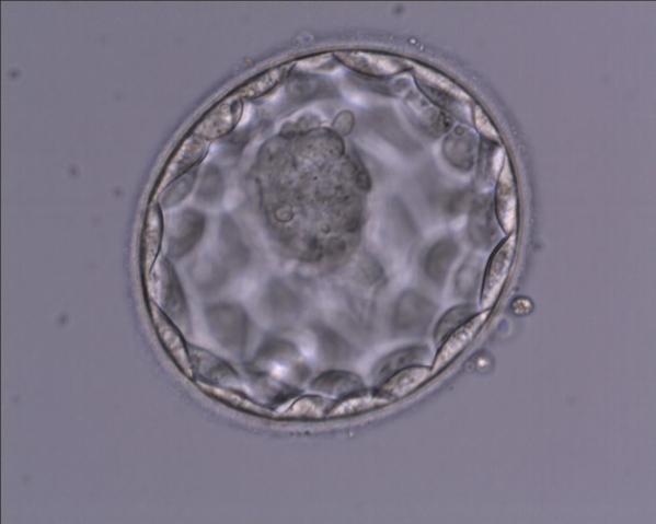 Avsnitt 100 – Vad händer med ägg och spermier på labbet?